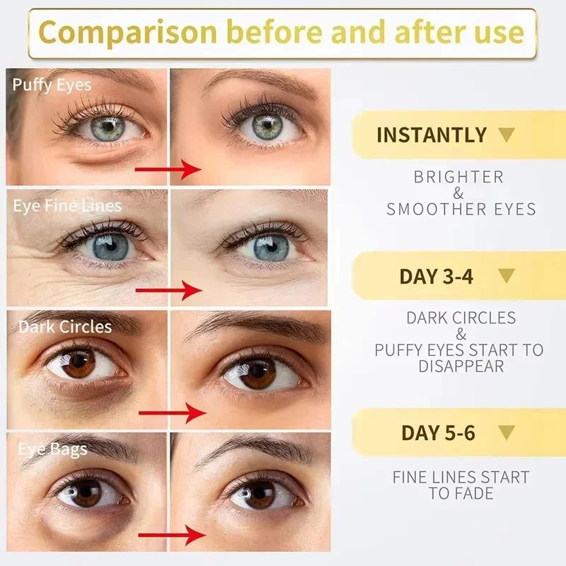 Instant Eye Bag Removal Cream – Collagen Anti-Wrinkle Formula to Firm Skin, Fade Fine Lines & Brighten Dark Circles