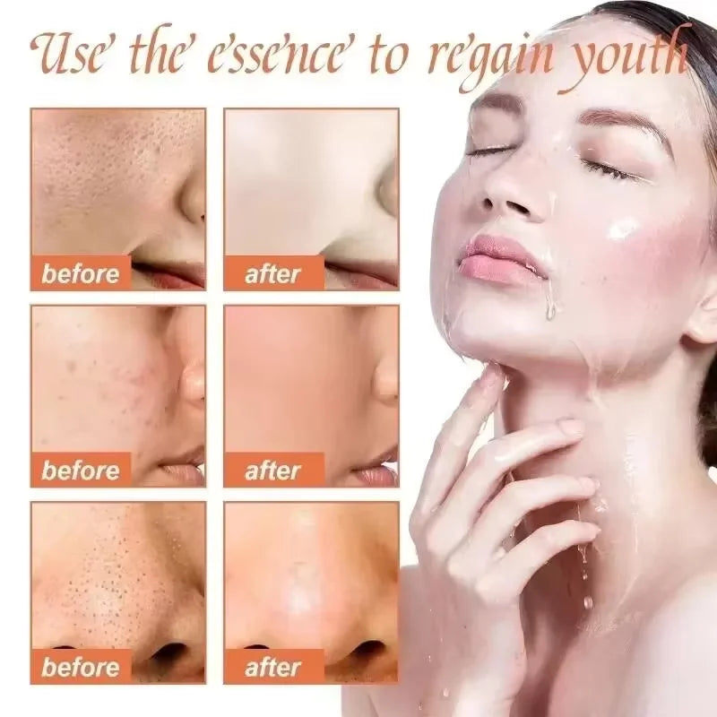 The Secret to Radiant Skin: White Rice Whitening Serum for Pore Shrinking and Fine Line Reduction